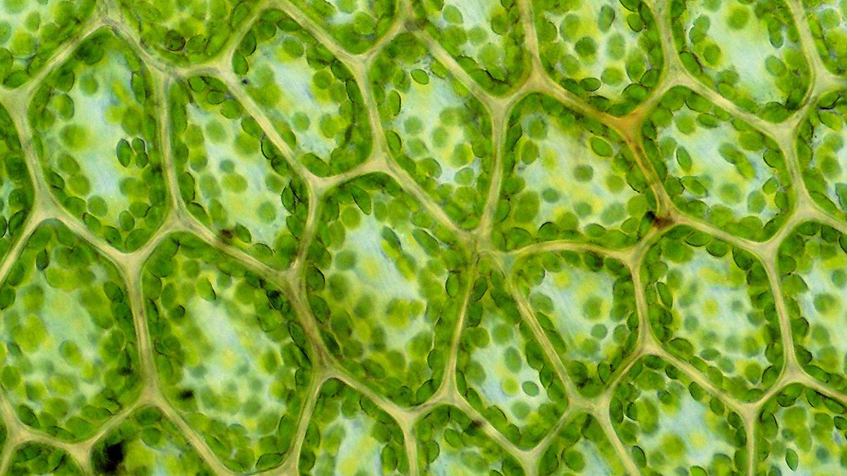 Plant cells under a microscope, showing chloroplasts